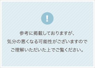 症例図